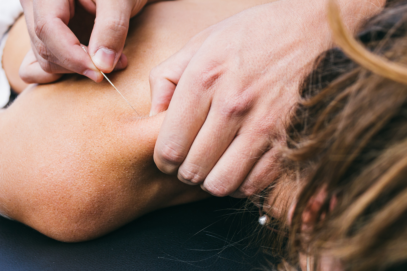 Physiotherapie Laurentiusbad Dry Needling